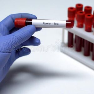 Enfermeiro Confessa Ter Extraído O Próprio Sangue Para Proteger Médico Em Teste De álcool Em Coimbra
