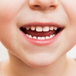 Soure Dinamiza ‘Lanche Amigo Dos Dentes’ Nas Escolas Do 1º Ciclo No âmbito Do Dia Mundial Da Saúde Oral